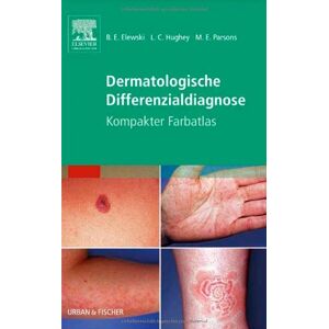 Elewski, Boni E. - GEBRAUCHT Dermatologische Differenzialdiagnose: Kompakter Farbatlas - Preis vom 29.04.2024 04:59:55 h