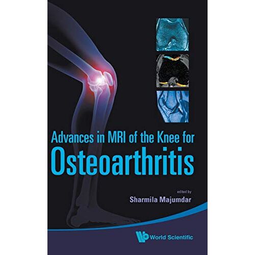 Sharmila Majumdar – Advances in MRI of the Knee for Osteoarthritis