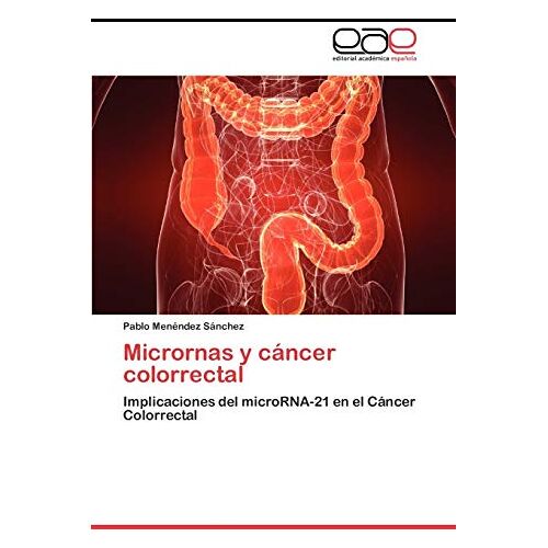 Pablo Menéndez Sánchez – Micrornas y cáncer colorrectal: Implicaciones del microRNA-21 en el Cáncer Colorrectal