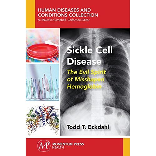 Eckdahl, Todd T. - Sickle Cell Disease: The Evil Spirit of Misshapen Hemoglobin