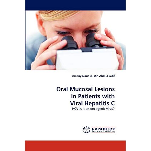 El- Din Abd El-Latif, Amany Nour – Oral Mucosal Lesions in Patients with Viral Hepatitis C: HCV-Is it an oncogenic virus?