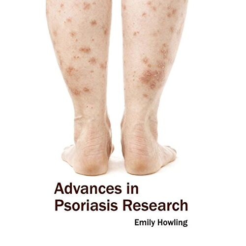 Emily Howling – Advances in Psoriasis Research