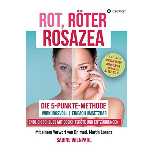 Sabine Wienpahl – ROT RÖTER ROSAZEA: Die 5-Punkte-Methode – Endlich Schluss mit Gesichtsröte und Entzündungen