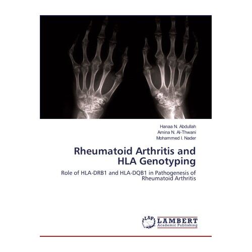 Abdullah, Hanaa N. – Rheumatoid Arthritis and HLA Genotyping: Role of HLA-DRB1 and HLA-DQB1 in Pathogenesis of Rheumatoid Arthritis