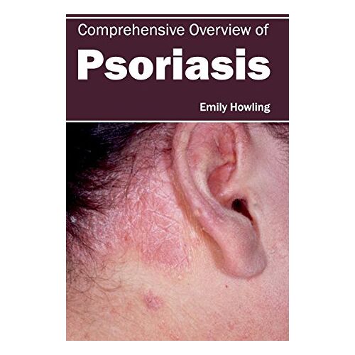 Emily Howling – Comprehensive Overview of Psoriasis