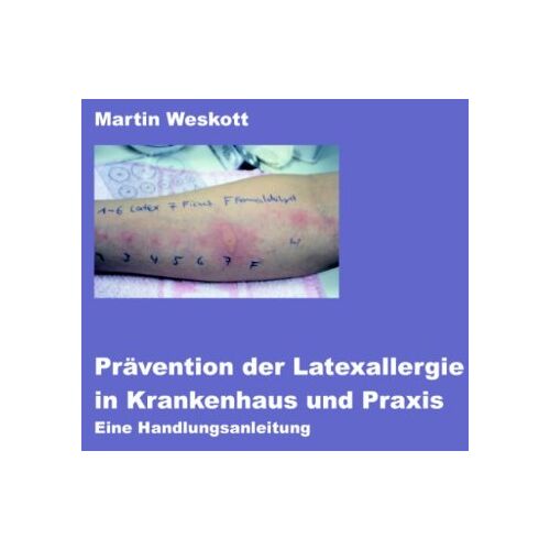 Martin Weskott – Prävention der Latexallergie in Krankenhaus und Praxis