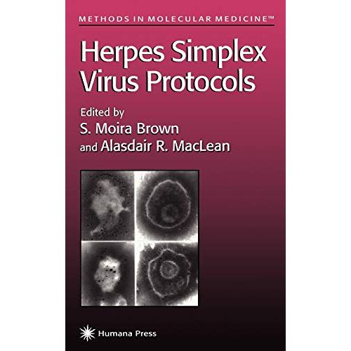 Brown, S. Moira – Herpes Simplex Virus Protocols (Methods in Molecular Medicine, 10, Band 10)