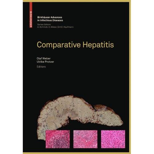 Olaf Weber – Comparative Hepatitis (Birkhäuser Advances in Infectious Diseases)
