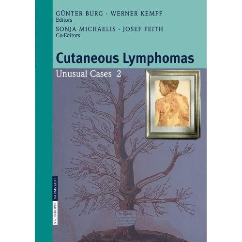 G. Burg – Cutaneous Lymphomas: Unusual Cases 2