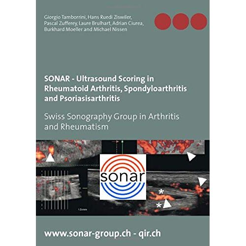 Giorgio Tamborrini – SONAR – Ultrasound Scoring in Rheumatoid Arthritis, Spondyloarthritis and Psoriasisarthritis: Swiss Sonography Group in Arthritis and Rheumatism