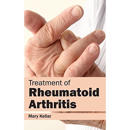 Mary Kellar – Treatment of Rheumatoid Arthritis