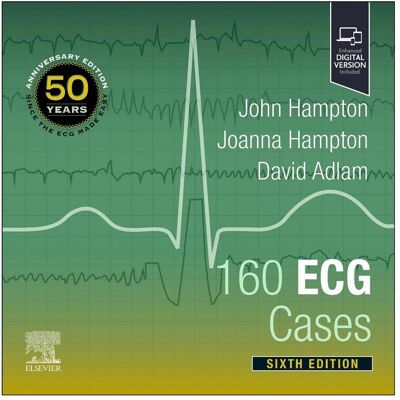 Elsevier 160 ECG Cases, Fachbücher von John Hampton, Joanna Hampton, Adlam David Elsevier 160 ECG Cases, Fachbücher von John Hampton, Joanna Hampton, Adlam David
