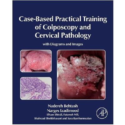 Elsevier Case-Based Practical Training of Colposcopy and Cervical Pathology, Fachbücher von Nadereh Behtash, Elham Shirali, Sara Ramhormozian, Fatemeh Nili, Narges Izadimood, Shahrzad Sheikhhasani Elsevier Case-Based Practical Training of Colposcopy and Cervical Pathology, Fachbücher von Nadereh Behtash, Elham Shirali, Sara Ramhormozian, Fatemeh Nili, Narges Izadimood, Shahrzad Sheikhhasani