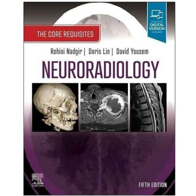 Elsevier Neuroradiology, Fachbücher von Doris Lin, David M. Yousem, Rohini Nadgir Elsevier Neuroradiology, Fachbücher von Doris Lin, David M. Yousem, Rohini Nadgir