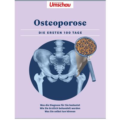 Edel Apotheken Umschau: Osteoporose, Ratgeber von Wort & Bild Verlag Edel Apotheken Umschau: Osteoporose, Ratgeber von Wort & Bild Verlag