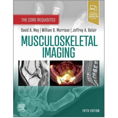 Elsevier Musculoskeletal Imaging, Fachbücher von David A. May, Jeffrey A. Belair, William Brian Morrison Elsevier Musculoskeletal Imaging, Fachbücher von David A. May, Jeffrey A. Belair, William Brian Morrison