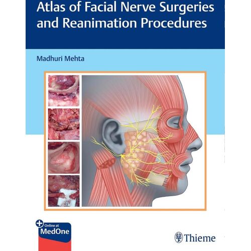 Thieme Medical Publishers Atlas Of Facial Nerve Surgeries And Reanimation Procedures