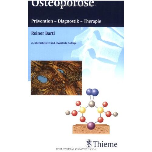 Osteoporose: Prävention – Diagnostik – Therapie