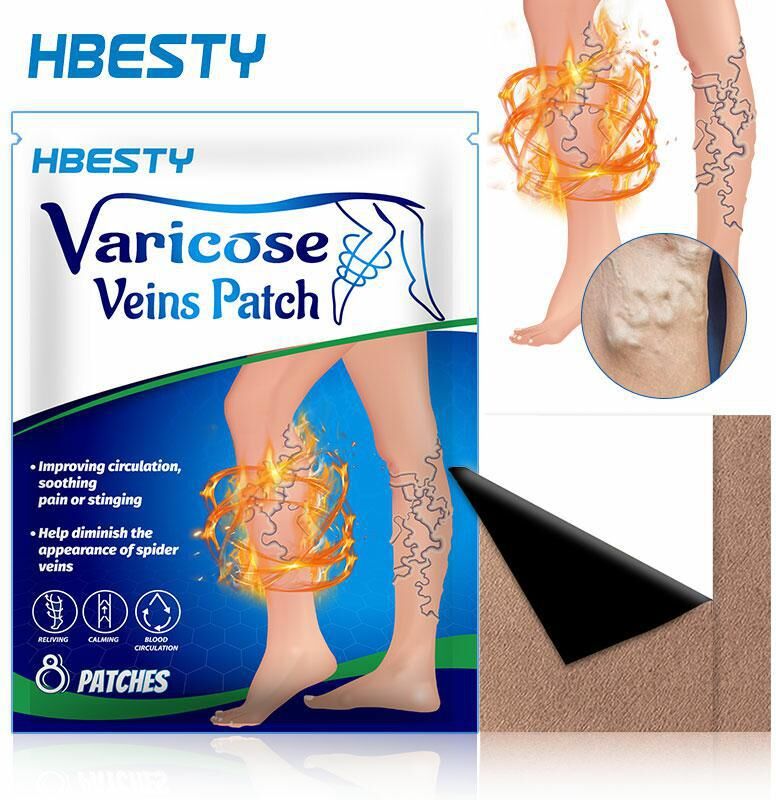 Herbal Patch Krampfadern Behandlung Gips Vaskulitis Venenentzündung Spinne Bein Chinesische Medizinische Patch Angiitis Entfernung Patch Gesundheit Pflege