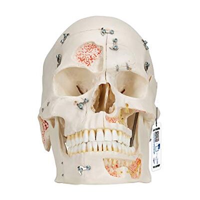 3B Scientific ® Luxus-Schädelmodell – 10-teiliges menschliches Schädelmodell für umfassende Demonstrationen + Smart Anatomy App (5 Jahre Garantie) 3B Scientific ® Luxus-Schädelmodell – 10-teiliges menschliches Schädelmodell für umfassende Demonstrationen + Smart Anatomy App (5 Jahre Garantie)
