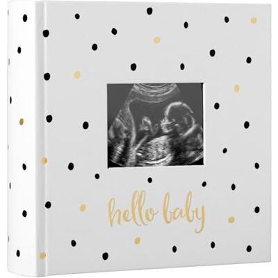 Pearhead Baby-Fotoalbum, Babybuch Andenken für frischgebackene und werdende Eltern, geschlechtsneutrales Baby-Accessoire, Schwarz und Gold gepunktet Pearhead Baby-Fotoalbum, Babybuch Andenken für frischgebackene und werdende Eltern, geschlechtsneutrales Baby-Accessoire, Schwarz und Gold gepunktet