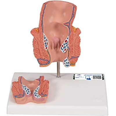 3B Scientific Menschliche Anatomie Hämorrhoidenmodell + kostenlose Anatomie App 3B Smart Anatomy 3B Scientific Menschliche Anatomie Hämorrhoidenmodell + kostenlose Anatomie App 3B Smart Anatomy