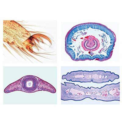 3B Scientific LIEDER Mikropräparat Serie: Wirbellose Tiere (Invertebrata), Grundserie 25 Präparate 3B Scientific LIEDER Mikropräparat Serie: Wirbellose Tiere (Invertebrata), Grundserie 25 Präparate