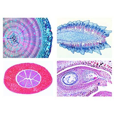 3B Scientific LIEDER Biologie Mikroskopie Mikropräparate Serien: Serie Nacktsamer (Gymnospermae), 15 Präparate 3B Scientific LIEDER Biologie Mikroskopie Mikropräparate Serien: Serie Nacktsamer (Gymnospermae), 15 Präparate