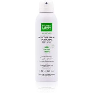 Martiderm Acniover Body Spray 150 ml Martiderm Acniover Body Spray 150 ml