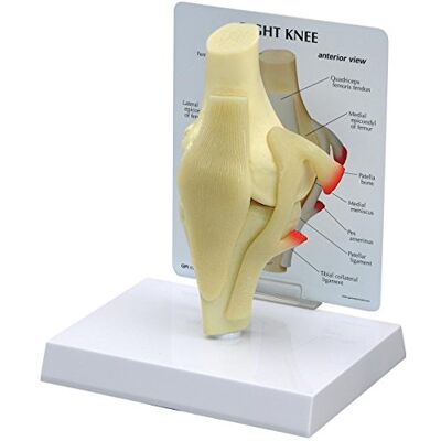 3B Scientific GPI Anatomicals 1000 Einfaches Kniemodell 3B Scientific GPI Anatomicals 1000 Einfaches Kniemodell