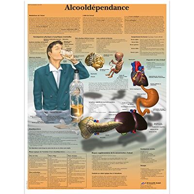 3B Scientific – Laminierte Alkoholabhängigkeit Tafel – UV- & Staubgeschütztes Lehrposter für Studium, Lehre & Kliniken 3B Scientific – Laminierte Alkoholabhängigkeit Tafel – UV- & Staubgeschütztes Lehrposter für Studium, Lehre & Kliniken