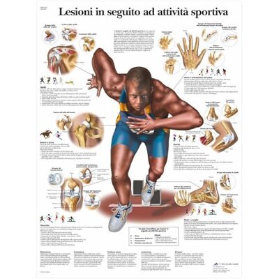 3B Scientific – Laminierte Sportverletzungen Tafel – UV- & Staubgeschütztes Anatomieposter für Studium, Lehre & Kliniken 3B Scientific – Laminierte Sportverletzungen Tafel – UV- & Staubgeschütztes Anatomieposter für Studium, Lehre & Kliniken