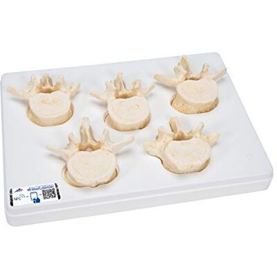 3B Scientific Menschliche Anatomie Set mit 5 Lendenwirbeln + kostenlose Anatomie App 3B Smart Anatomy 3B Scientific Menschliche Anatomie Set mit 5 Lendenwirbeln + kostenlose Anatomie App 3B Smart Anatomy