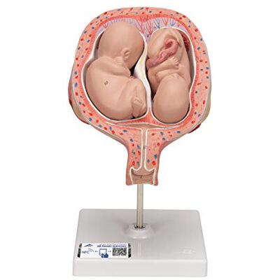 3B Scientific Menschliche Anatomie Zwillingsfeten, 5. Monat, normale Position + kostenlose Anatomie App 3B Smart Anatomy 3B Scientific Menschliche Anatomie Zwillingsfeten, 5. Monat, normale Position + kostenlose Anatomie App 3B Smart Anatomy