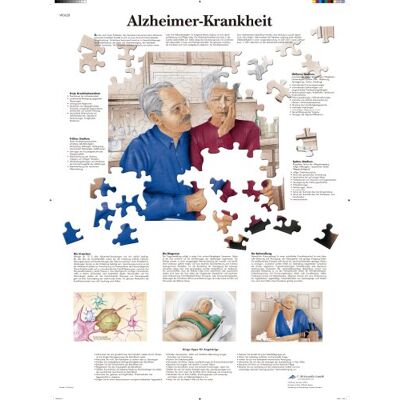 3B Scientific Lehrtafel laminiert Alzheimer-Krankheit 3B Scientific Lehrtafel laminiert Alzheimer-Krankheit