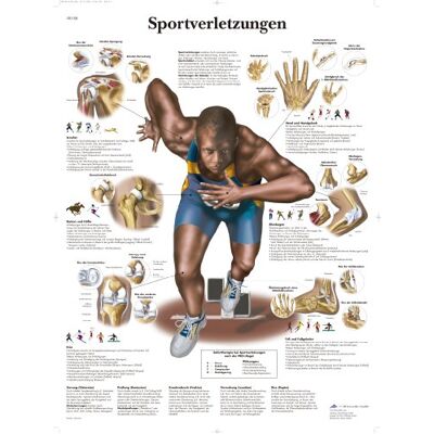 3B Scientific Lehrtafel Sportverletzungen, VR0188UU 3B Scientific Lehrtafel Sportverletzungen, VR0188UU