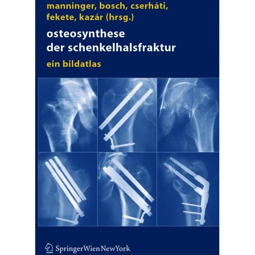 Springer Vienna Osteosynthese der Schenkelhalsfraktur