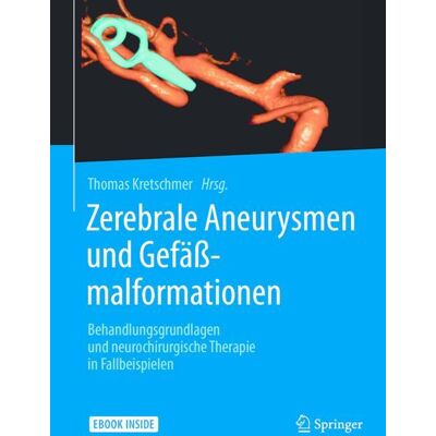 Springer Berlin Heidelberg Zerebrale Aneurysmen und Gefäßmalformationen Springer Berlin Heidelberg Zerebrale Aneurysmen und Gefäßmalformationen