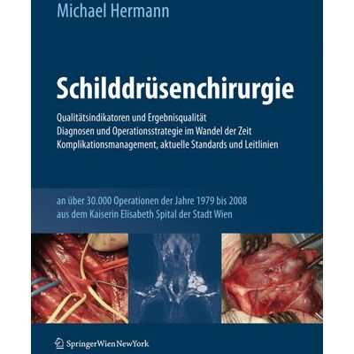 Springer Vienna Schilddrüsenchirurgie - Qualitätsindikatoren und Ergebnisqualität, Diagnosen und Operationsstrategie im Wandel der Zeit, Komplikationsmanagement, aktu Springer Vienna Schilddrüsenchirurgie - Qualitätsindikatoren und Ergebnisqualität, Diagnosen und Operationsstrategie im Wandel der Zeit, Komplikationsmanagement, aktu