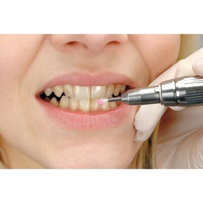 Megadent Deflogrip Gerhard Reeg GmbH POLIER- UND REINIGUNGSPASTE f.Zähne 2 g Megadent Deflogrip Gerhard Reeg GmbH POLIER- UND REINIGUNGSPASTE f.Zähne 2 g