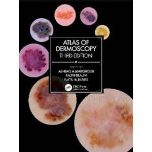 Atlas Of Dermoscopy