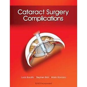 Lucio Buratto Cataract Surgery Complications