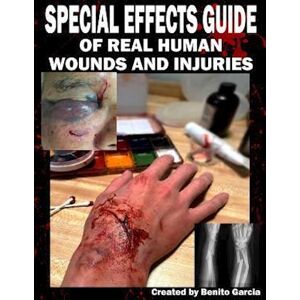 Benito Garcia III Special Effects Guide Of Real Human Wounds And Injuries