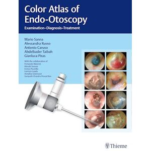 Mario Sanna Color Atlas Of Endo-Otoscopy: Examination-Diagnosis-Treatment