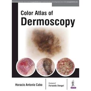 Horacio Antonio Cabo Color Atlas Of Dermoscopy