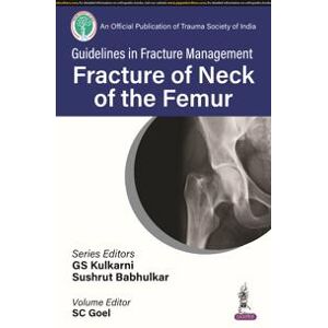 Guidelines in Fracture Management