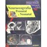 Marbán Neuroecografía Prenatal Y Neonatal