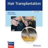 THIEME MEDICAL PUBL INC Hair Transplantation