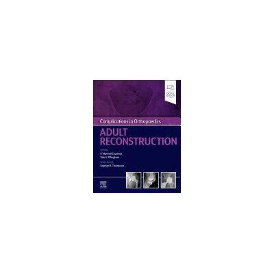 Elsevier - Health Sciences Division Complications In Orthopaedics: Adult Reconstruction Elsevier - Health Sciences Division Complications In Orthopaedics: Adult Reconstruction