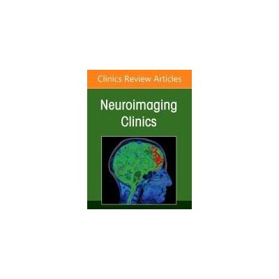 Elsevier Management And Treatment Of Cerebral Aneurysms, An Issue Of Neuroimaging Clinics Of North America Elsevier Management And Treatment Of Cerebral Aneurysms, An Issue Of Neuroimaging Clinics Of North America
